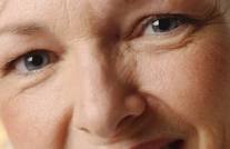 Get-Rid-of-Under-Eye-Wrinkles-–-Causes-Treatments-Remedies-and-Prevention