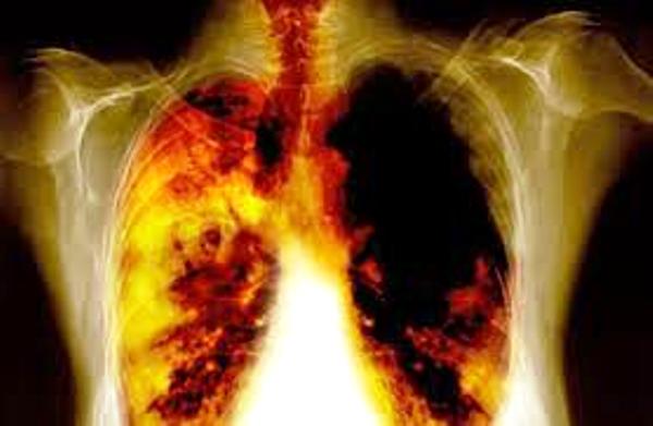 more-than-700-000-chinese-to-die-from-lung-cancer-yearly-by-2020