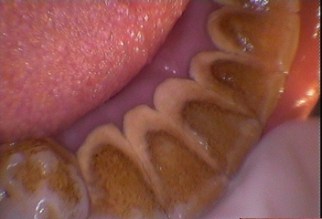 dt-derya-konyar-kotu-agiz-hijyeni