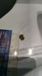 bobrek-tasi-hakankonyar-com